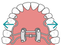 側方移動する場合