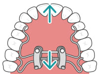 後方移動する場合