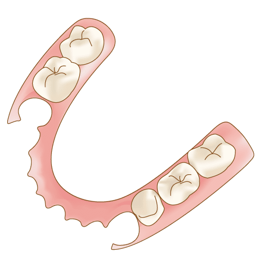 【ノンクラスプデンチャー】軽くて薄く、目立たない入れ歯