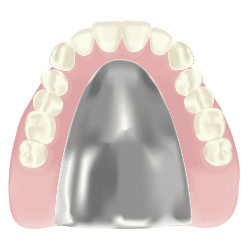 【金属床入れ歯】食べ物の味を損なわない