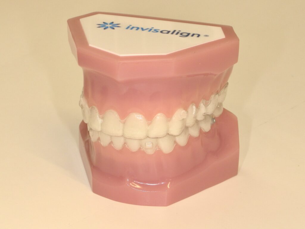 山形 山形市 矯正 歯科 インビザライン 大人 小児