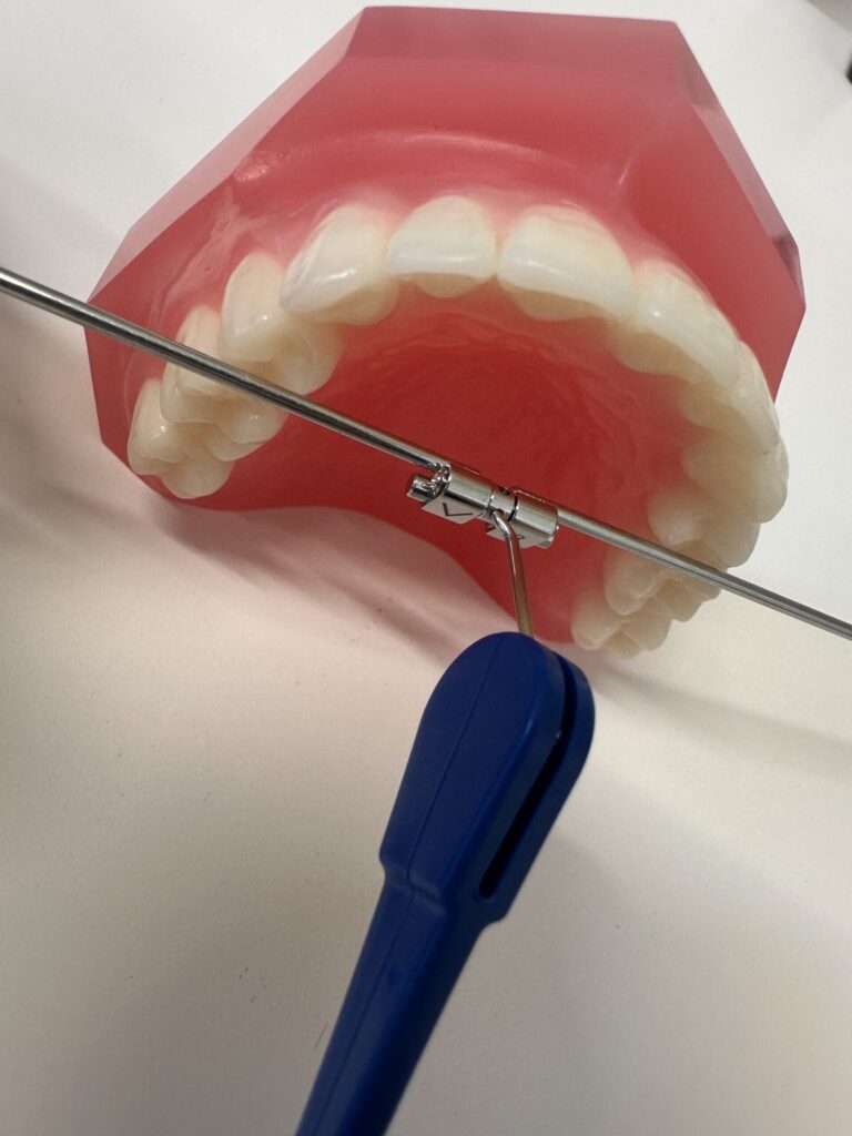 拡大装置の金具を回しているところ