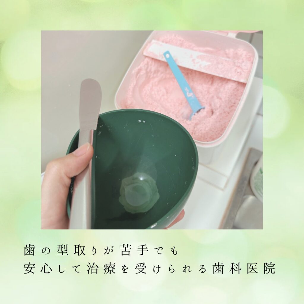 アルジネートによる型取り