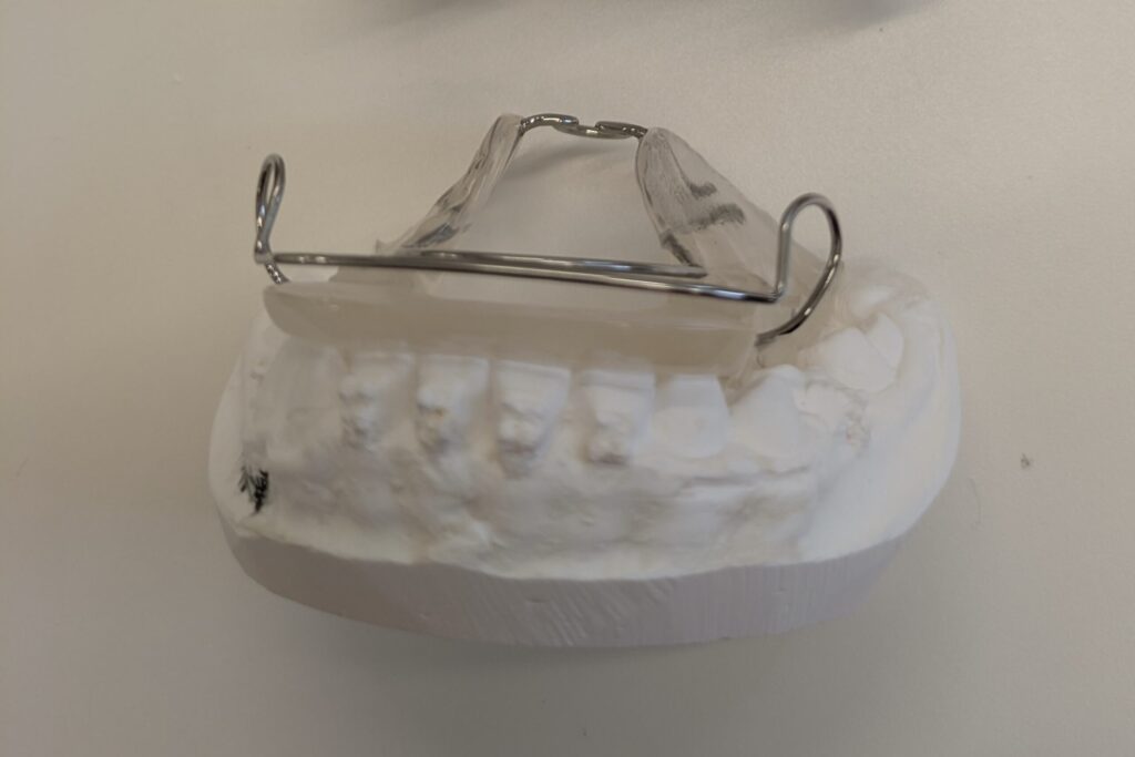 バイオネーターの基本構造