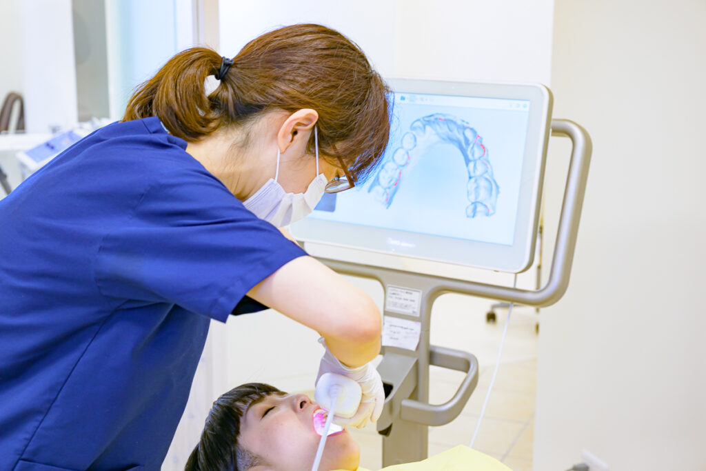 口腔内スキャン