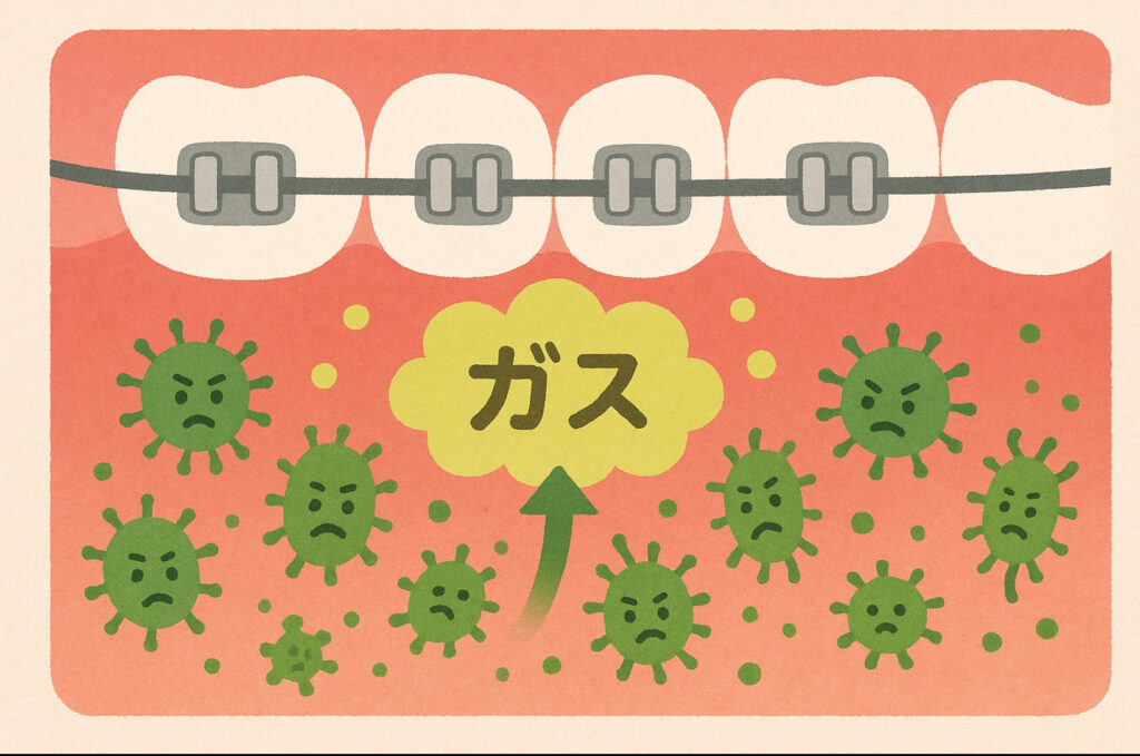 揮発性硫黄化合物（VSC）