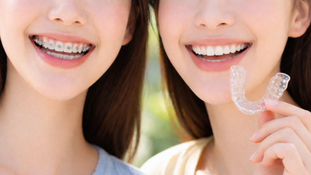 ブラケット矯正中・マウスピース矯正中の口元