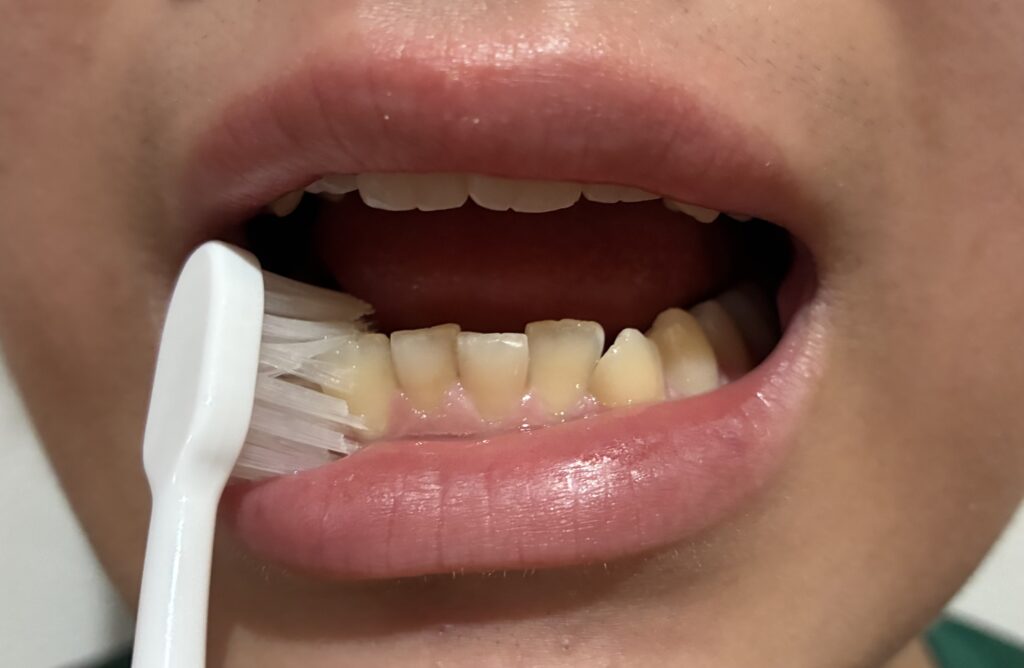 山形 山形市 歯医者 歯科医院 クリニック 歯磨き ブラッシング むし歯 一般歯科 治療 新しい きれい デンタルケア 口腔ケア 歯ブラシ ごとう ごとう歯科 旅籠町