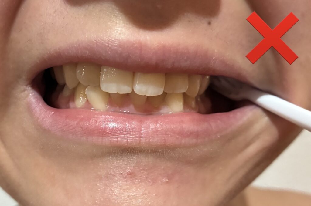 山形 山形市 歯医者 歯科医院 クリニック 歯磨き ブラッシング むし歯 一般歯科 治療 新しい きれい デンタルケア 口腔ケア 歯ブラシ ごとう ごとう歯科 旅籠町