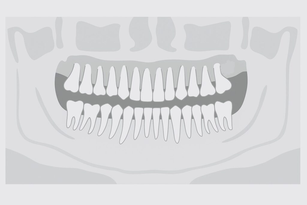 パノラマX線写真