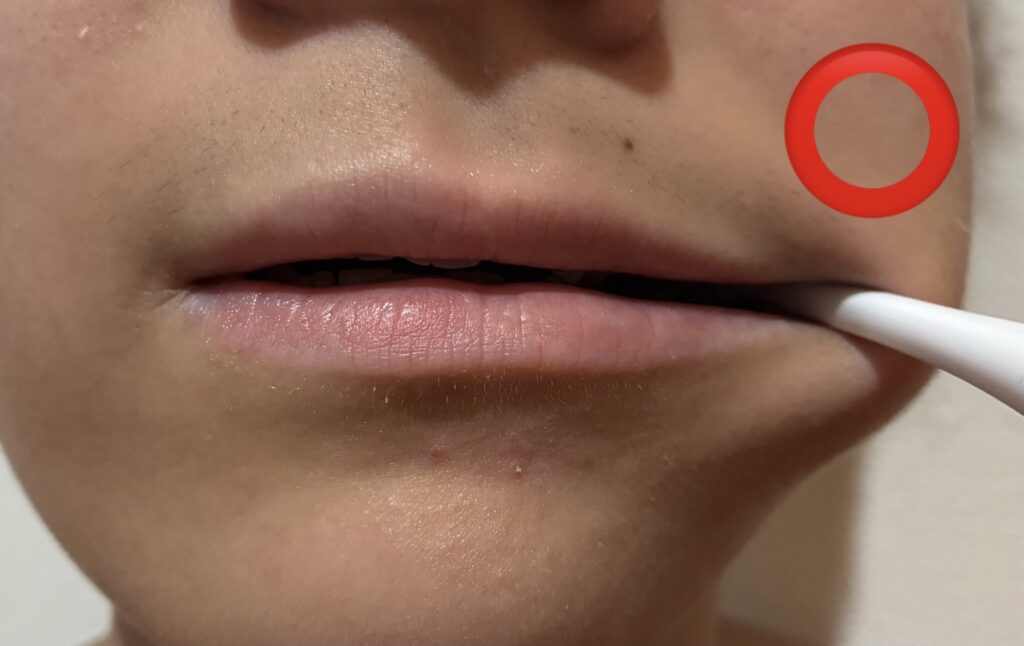 奥歯の正しいブラッシング方法