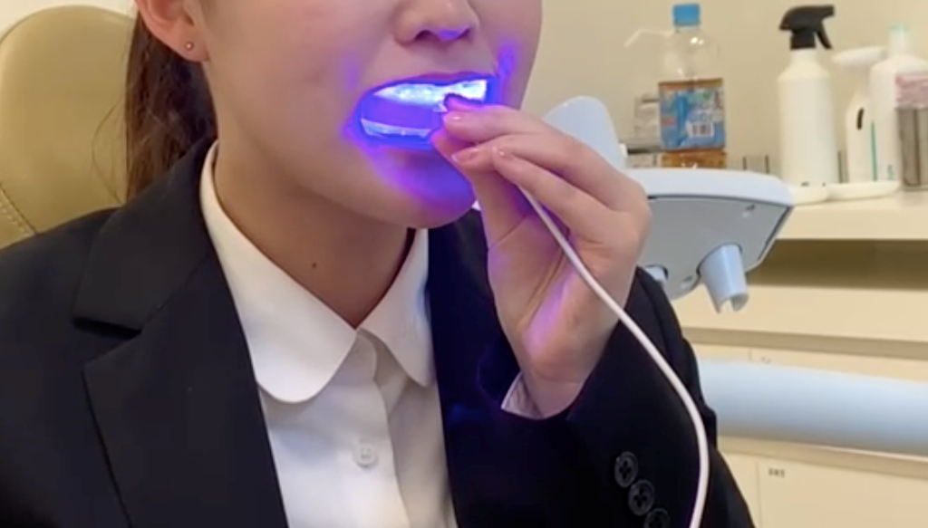 表側マルチブラケット矯正の場合のホワイトニング