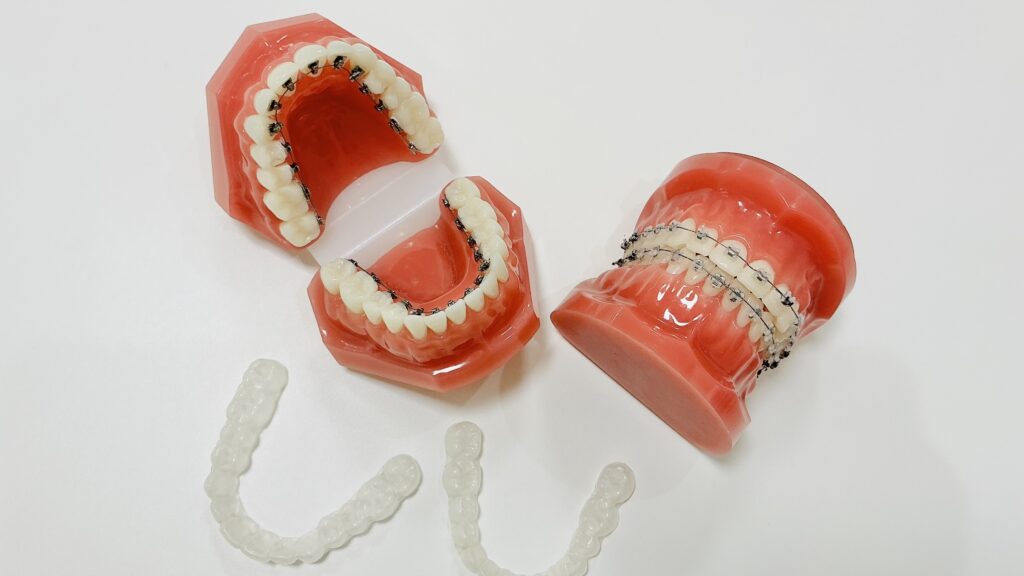 ごとう 後藤歯科 ごとう歯科 矯正歯科 山形 山形市 旅籠町 矯正 必要 歯並び 大人 こども 治療 装置 リスク タイミング