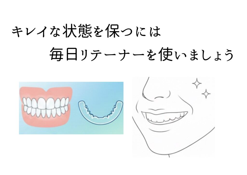 ごとう　後藤　矯正歯科　歯医者　矯正器具　装置　王道　メジャー　マルチブラケット　ワイヤー　セラミック　透明　表側　治療期間　痛み　仕組み　メリット　向いている　適応　歯並び　症例　山形　　　山形市　ごとう歯科　矯正専門医　認定医