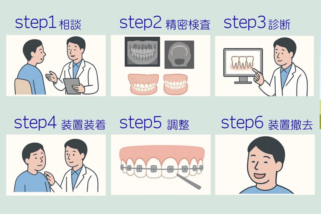 表側マルチブラケット矯正の治療の流れ