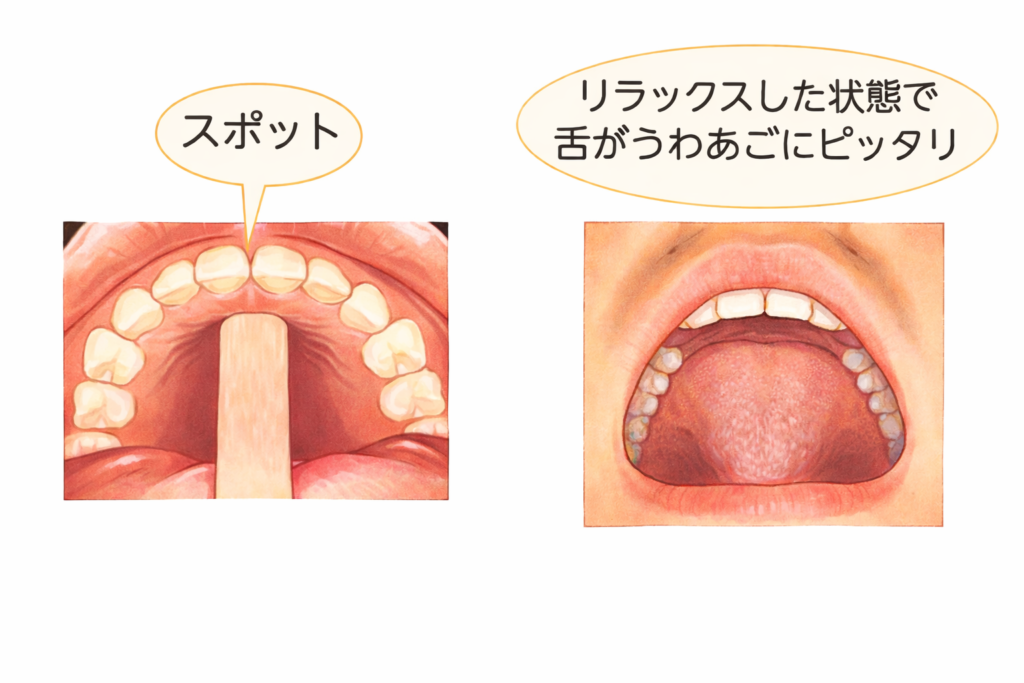 リラックスした状態で、舌が上顎にぴったり当たっている画像