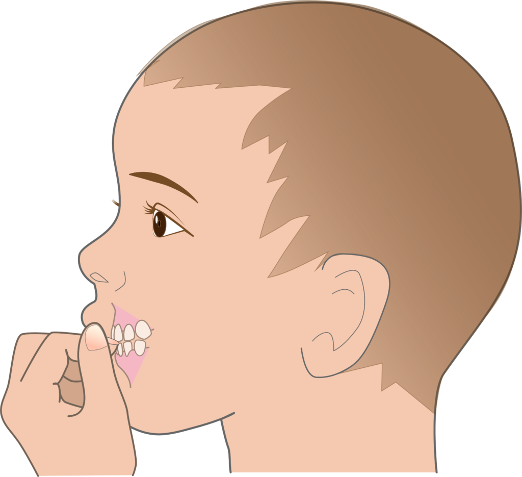 爪噛みの習慣を説明するために用いられる、こどものイラスト