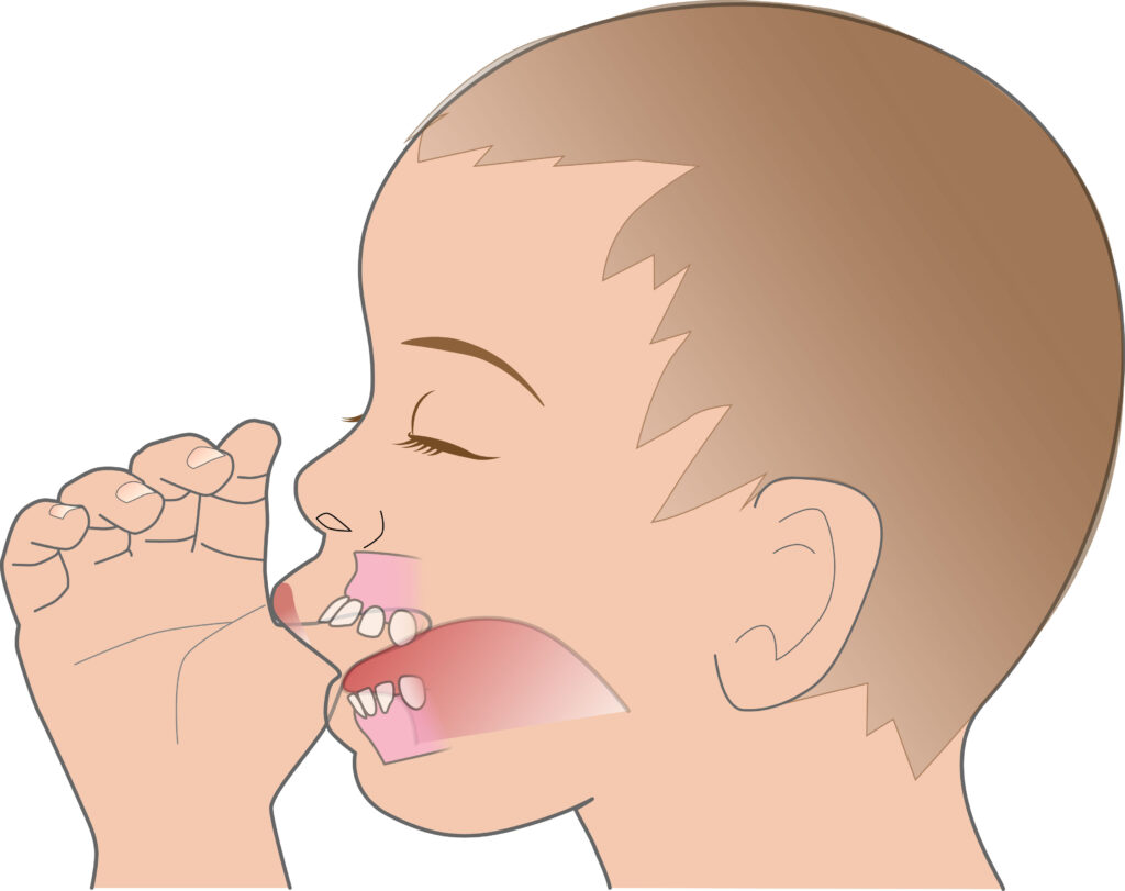 指しゃぶりの習慣を説明するために用いられる、こどものイラスト