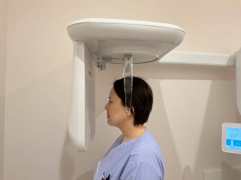 頭部X線規格写真(セファログラム)を撮影している様子