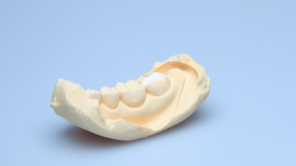 セラミックの模型