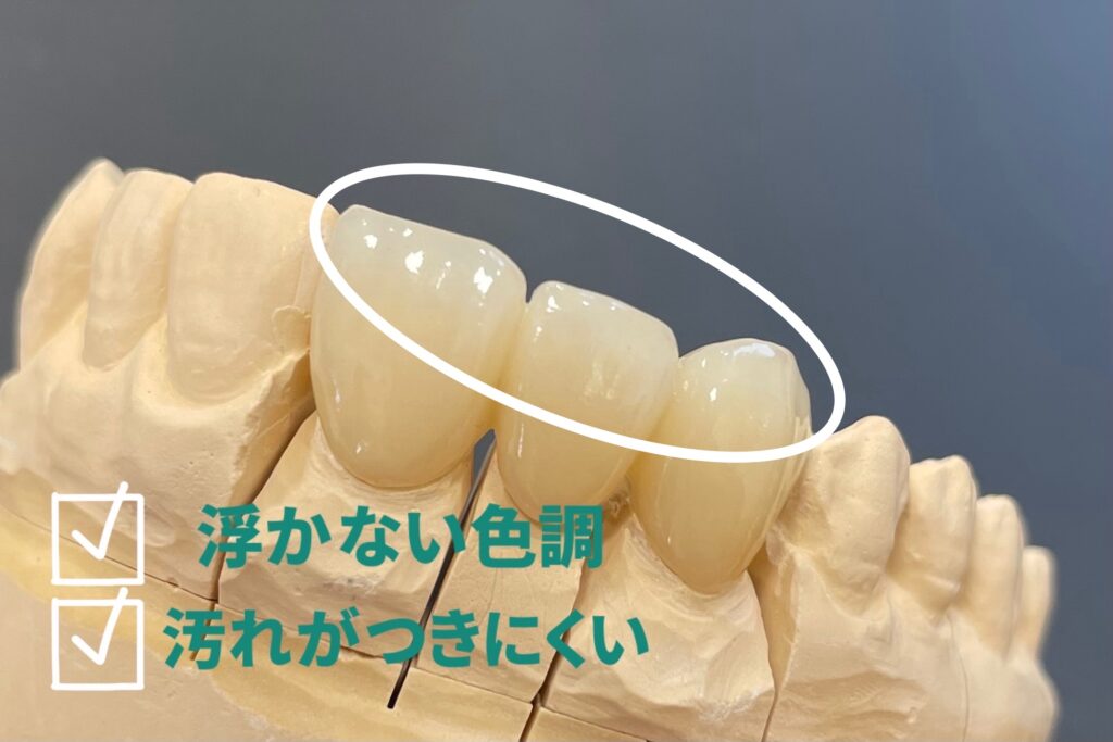 オールセラミックの模型