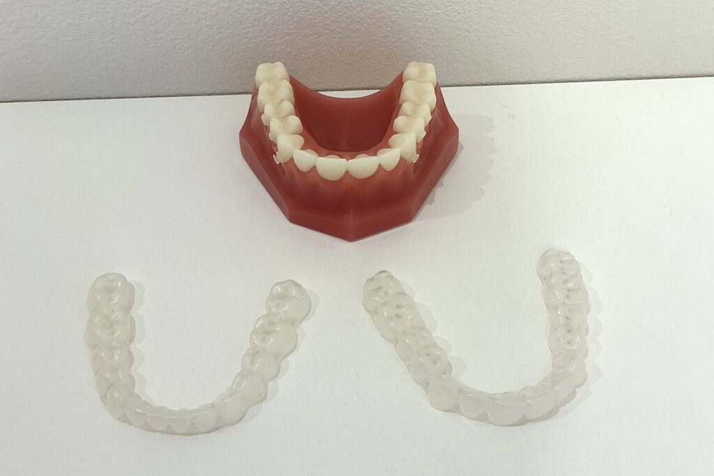マウスピース矯正の模型