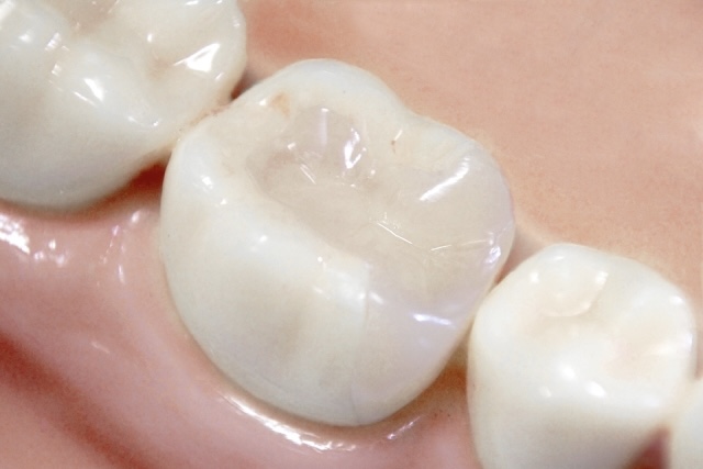 白い歯を上から見た画像