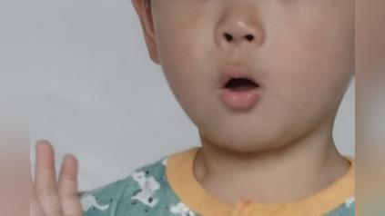 無意識に口が開いてしまうこども