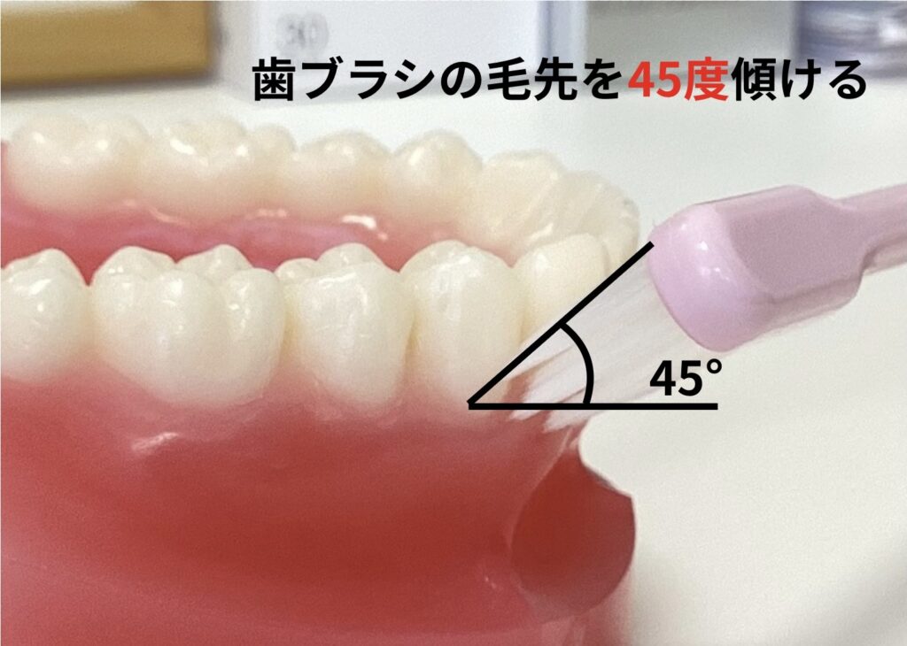 歯ブラシの毛先を45度傾ける
