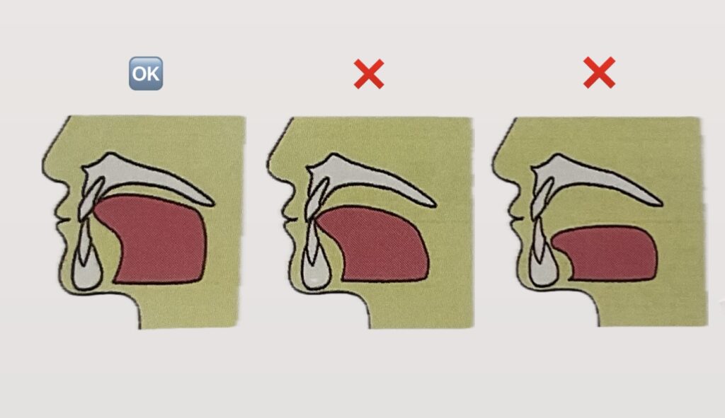 正しい舌の位置と舌癖がある場合の舌の位置