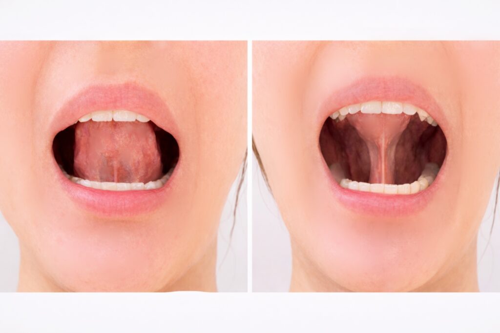 WFTトレーニング