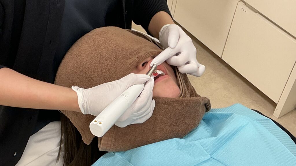 プロフェッショナルクリーニングの様子