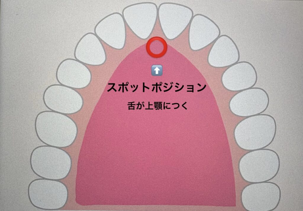舌の正しい位置(スポットポジション)