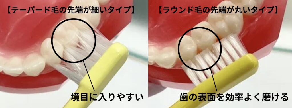 歯ブラシの毛先の形状の比較