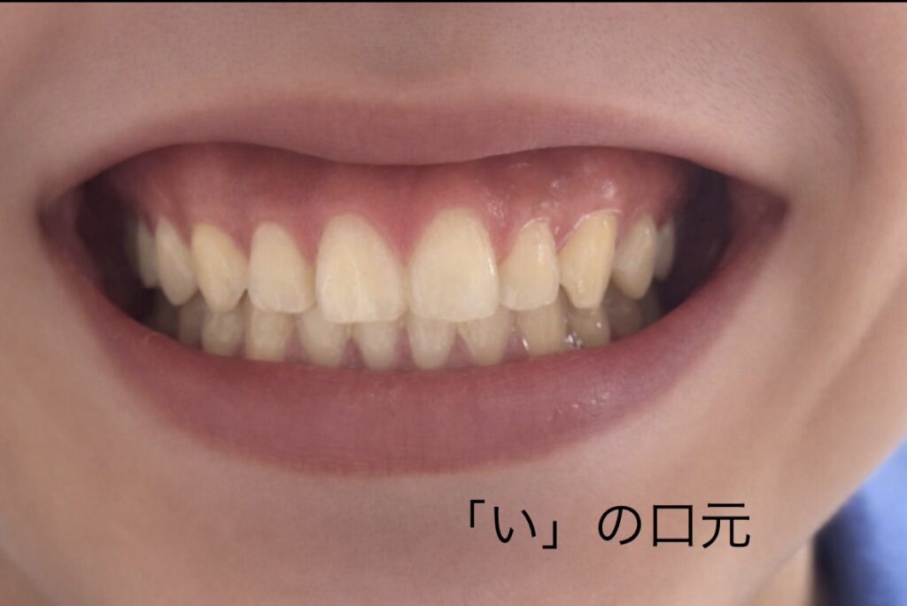 「い」の口元