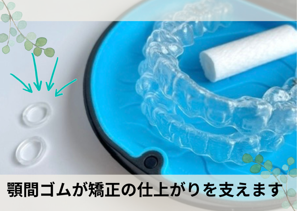 顎間ゴムのまとめ