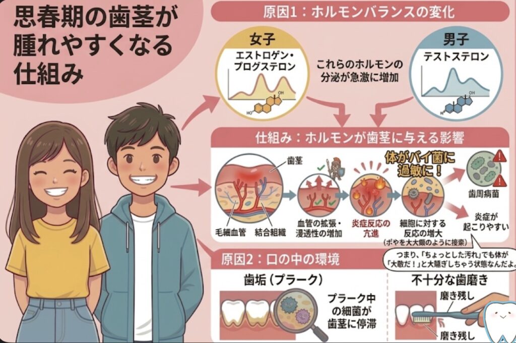 思春期の歯茎が腫れやすくなる仕組み