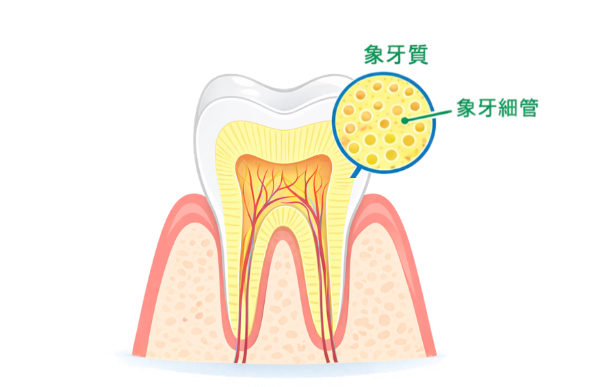 象牙質