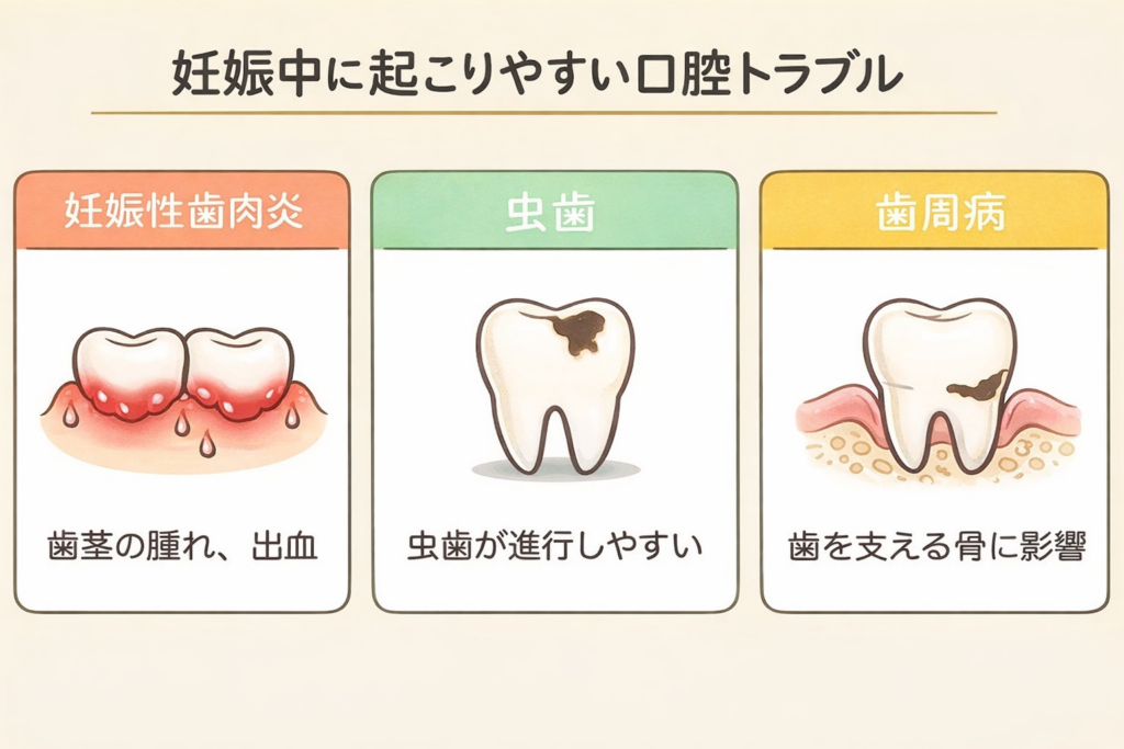 妊娠中の口腔トラブル