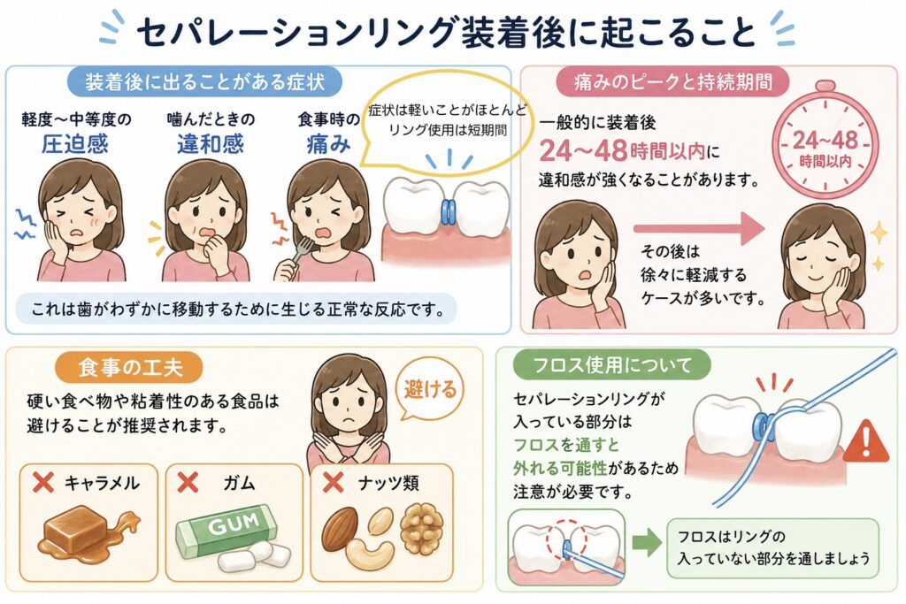 セパレーションリング装着後に起こること