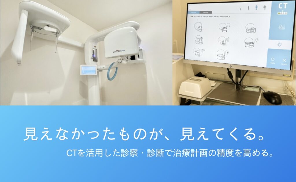 CTを活用した診療・診断