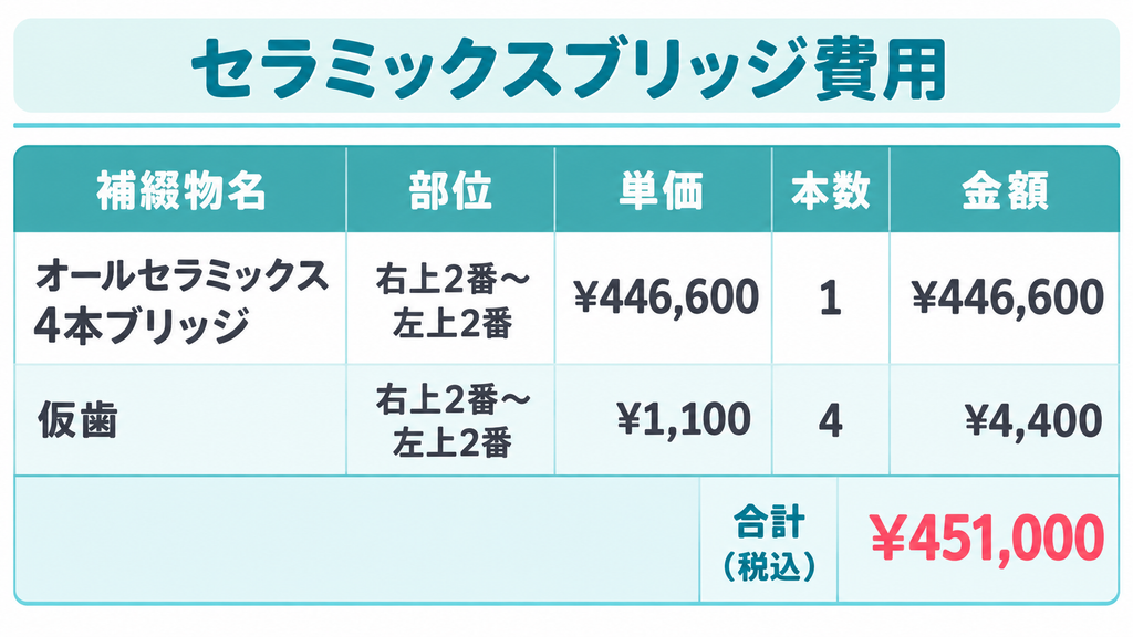 セラミックスブリッジ費用
