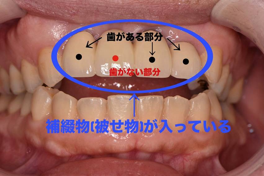 初診時の状態