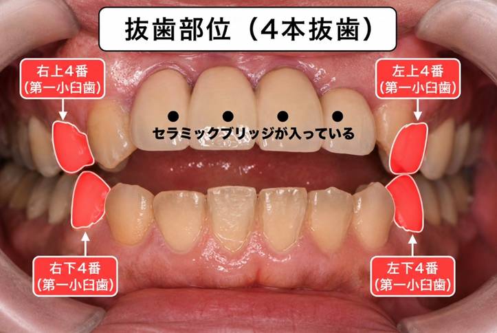 治療開始