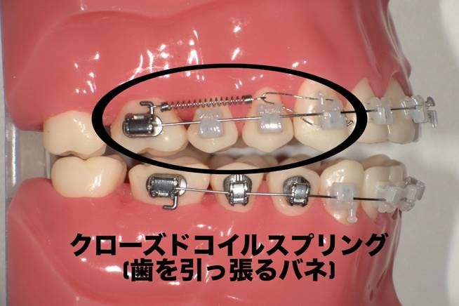 クローズドコイルスプリング
