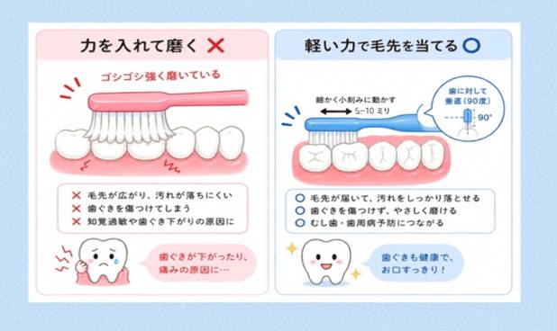 ブラッシングの正解・不正解