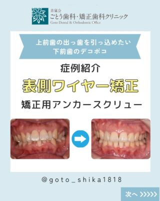 矯正治療の歴史について | ごとう歯科・矯正歯科クリニック
